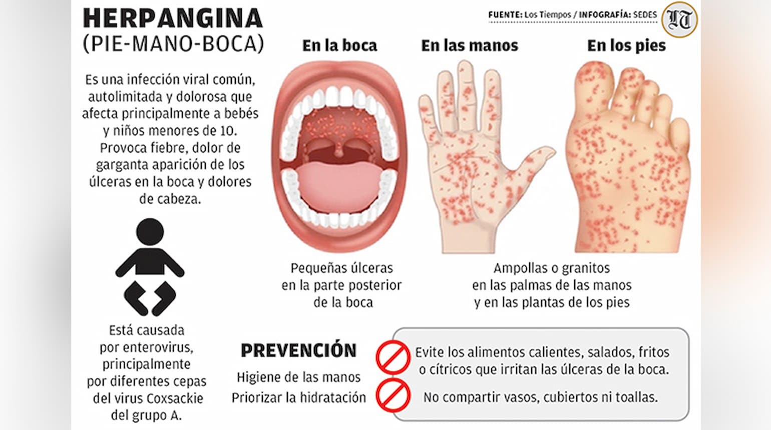 El brote de herpangina en unidades educativas de Cochabamba obliga a cuidar síntomas.jpg